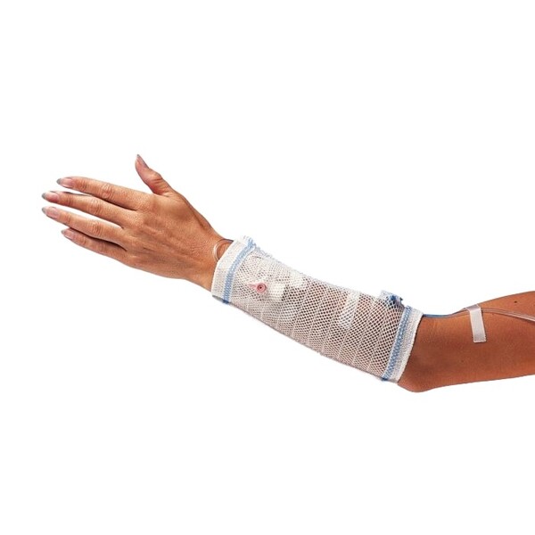 Voor de arm