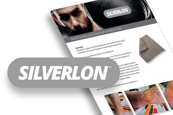 Nederlandse casestudies Silverlon!