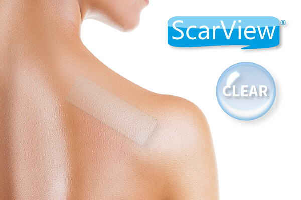 Beoordeel littekens eenvoudig met ScarView Clear